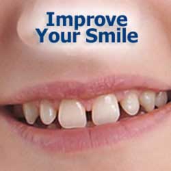 Options to Improve your Smile. Improve Your Smile